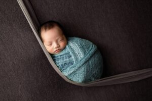 ダーマペン4のダウンタイムは何日かかるの？