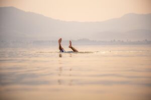 水光注射のダウンタイムはいつまで続くのか？